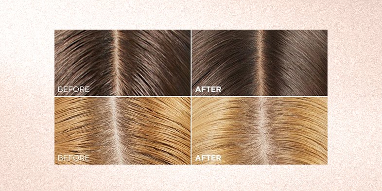 InArticlehairtexturesShampoo Hyaluron Pure Purifying Shampoo For Oily Hair